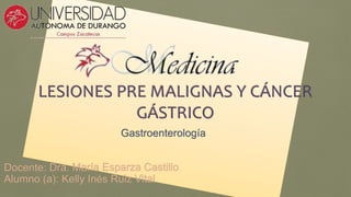 LESIONES PRE MALIGNAS Y CÁNCER
GÁSTRICO
Gastroenterología
Docente: Dra. María Esparza Castillo
Alumno (a): Kelly Inés Ruiz Vital
 