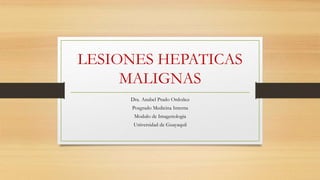 LESIONES HEPATICAS
MALIGNAS
Dra. Anabel Prado Ordoñez
Posgrado Medicina Interna
Modulo de Imagenologia
Universidad de Guayaquil
 