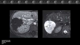 DIAGNOSTICO POR
IMAGEN. ABDOMEN.
FEDERLE.
2011.
 