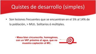 Quistes de desarrollo (simples)
• Son lesiones frecuentes que se encuentran en el 5% al 14% de
la población, > MUJ. Solitarios ó múltiples.
• Masa bien circunscrita, homogénea,
con un VAT próximo al agua, que no
muestra captación al MC.
 