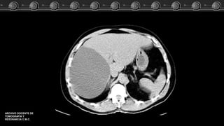 ARCHIVO DOCENTE DE
TOMOGRAFÍA Y
RESONANCIA C.M.C.
 