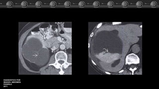 DIAGNOSTICO POR
IMAGEN. ABDOMEN.
FEDERLE.
2011.
 