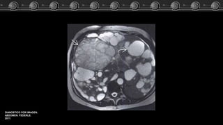 DIANOSTICO POR IMAGEN.
ABDOMEN. FEDERLE.
2011.
 