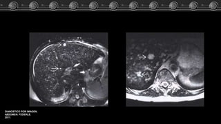 DIANOSTICO POR IMAGEN.
ABDOMEN. FEDERLE.
2011.
 