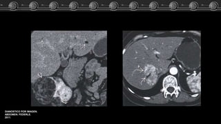 DIANOSTICO POR IMAGEN.
ABDOMEN. FEDERLE.
2011.
 