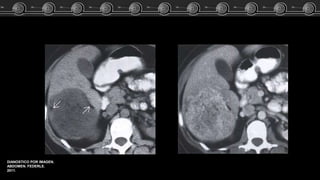 DIANOSTICO POR IMAGEN.
ABDOMEN. FEDERLE.
2011.
 