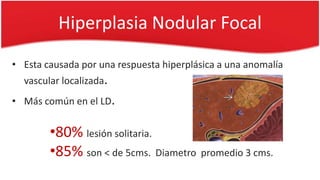 Hiperplasia Nodular Focal
• Esta causada por una respuesta hiperplásica a una anomalía
vascular localizada.
• Más común en el LD.
•80% lesión solitaria.
•85% son < de 5cms. Diametro promedio 3 cms.
 