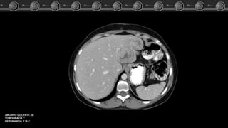 ARCHIVO DOCENTE DE
TOMOGRAFÍA Y
RESONANCIA C.M.C.
 
