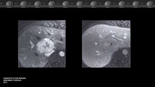 DIANOSTICO POR IMAGEN.
ABDOMEN. FEDERLE.
2011.
 