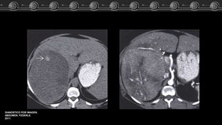 DIANOSTICO POR IMAGEN.
ABDOMEN. FEDERLE.
2011.
 