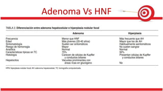 Adenoma Vs HNF
 
