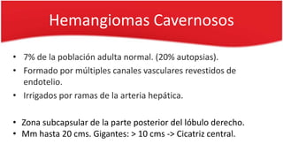 Hemangiomas Cavernosos
• 7% de la población adulta normal. (20% autopsias).
• Formado por múltiples canales vasculares revestidos de
endotelio.
• Irrigados por ramas de la arteria hepática.
• Zona subcapsular de la parte posterior del lóbulo derecho.
• Mm hasta 20 cms. Gigantes: > 10 cms -> Cicatriz central.
 