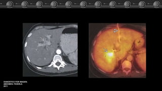DIANOSTICO POR IMAGEN.
ABDOMEN. FEDERLE.
2011.
 