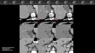 ARCHIVO DOCENTE DE
TOMOGRAFÍA Y
RESONANCIA C.M.C.
 