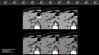 ARCHIVO DOCENTE DE
TOMOGRAFÍA Y
RESONANCIA C.M.C.
 