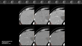 ARCHIVO DOCENTE DE
TOMOGRAFÍA Y
RESONANCIA C.M.C.
 