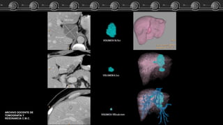 ARCHIVO DOCENTE DE
TOMOGRAFÍA Y
RESONANCIA C.M.C.
 