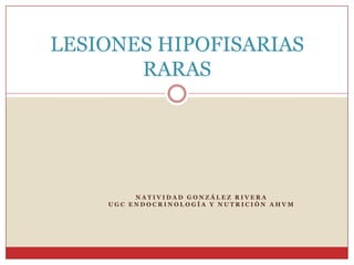 LESIONES HIPOFISARIAS
       RARAS




         NATIVIDAD GONZÁLEZ RIVERA
    UGC ENDOCRINOLOGÍA Y NUTRICIÓN AHVM
 