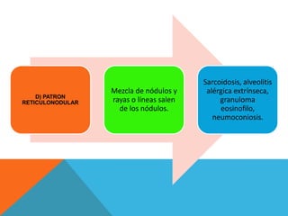 D) PATRON 
RETICULONODULAR 
Mezcla de nódulos y 
rayas o líneas salen 
de los nódulos. 
Sarcoidosis, alveolitis 
alérgica extrínseca, 
granuloma 
eosinofilo, 
neumoconiosis. 
 
