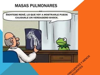 MASAS PULMONARES 
 