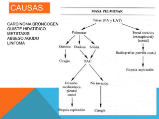 CAUSAS 
CARCINOMA BRONCOGENICO 
QUISTE HIDATIDICO 
METSTASIS 
ABSESO AGUDO 
LINFOMA 
 