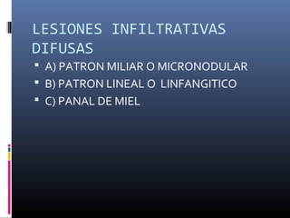 LESIONES INFILTRATIVAS
DIFUSAS
 A) PATRON MILIAR O MICRONODULAR
 B) PATRON LINEAL O LINFANGITICO
 C) PANAL DE MIEL
 
