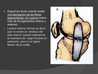  Esguinces leves cuando existe
una elongación de las fibras
ligamentarias sin ruptura (sobre
todo de los ligamentos interno y
externo).
 Laxitud interna normal, es decir,
que no existe un bostezo del
lado interno cuando realizamos
la maniobra de valgo forzado en
extensión, pero si en ligera
flexión de la rodilla
 