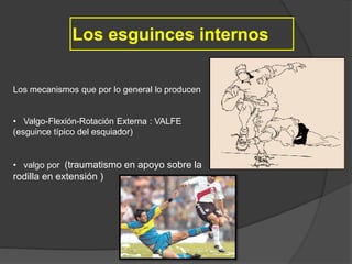 Los esguinces internos
Los mecanismos que por lo general lo producen
• Valgo-Flexión-Rotación Externa : VALFE
(esguince típico del esquiador)
• valgo por (traumatismo en apoyo sobre la
rodilla en extensión )
 