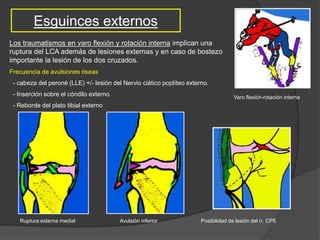 Esguinces externos
Varo flexión-rotación interna
Ruptura externa medial Avulsión inferior Posibilidad de lesión del n. CPE
Los traumatismos en varo flexión y rotación interna implican una
ruptura del LCA además de lesiones externas y en caso de bostezo
importante la lesión de los dos cruzados.
Frecuencia de avulsiones óseas
- cabeza del peroné (LLE) +/- lesión del Nervio ciático poplíteo externo.
- Inserción sobre el cóndilo externo
- Reborde del plato tibial externo
 