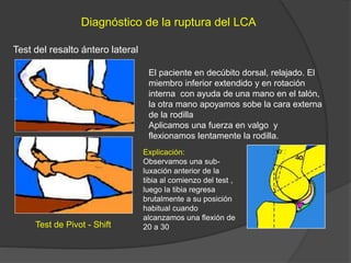 Test de Pivot - Shift
Diagnóstico de la ruptura del LCA
Test del resalto ántero lateral
El paciente en decúbito dorsal, relajado. El
miembro inferior extendido y en rotación
interna con ayuda de una mano en el talón,
la otra mano apoyamos sobe la cara externa
de la rodilla
Aplicamos una fuerza en valgo y
flexionamos lentamente la rodilla.
Explicación:
Observamos una sub-
luxación anterior de la
tibia al comienzo del test ,
luego la tibia regresa
brutalmente a su posición
habitual cuando
alcanzamos una flexión de
20 a 30
 