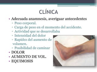 CLÍNICA
• Adecuada anamnesis, averiguar antecedentes
▫ Peso corporal.
▫ Carga de peso en el momento del accidente.
▫ Actividad que se desarrollaba
▫ Intensidad del dolor
▫ Rapidez del aumento de
volumen.
▫ Posibilidad de caminar
• DOLOR
• AUMENTO DE VOL.
• EQUIMOSIS
 