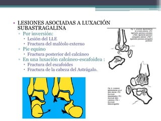 • LESIONES ASOCIADAS A LUXACIÓN
SUBASTRAGALINA
▫ Por inversión:
 Lesión del LLE
 Fractura del maléolo externo
▫ Pie equino
 Fractura posterior del calcáneo
▫ En una luxación calcáneo-escafoidea :
 Fractura del escafoides
 Fractura de la cabeza del Astrágalo.
 