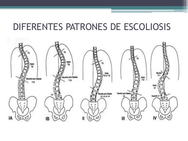 Las vitaminas a sheynom la osteocondrosis como curar