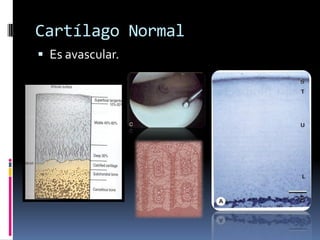 Cartílago Normal
 Es avascular.
 