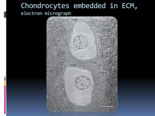 Chondrocytes embedded in ECM,
electron micrograph
 