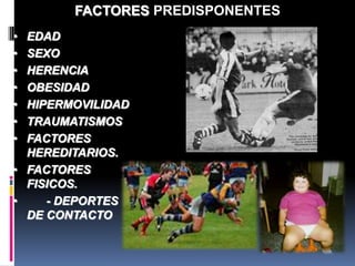 • EDAD
• SEXO
• HERENCIA
• OBESIDAD
• HIPERMOVILIDAD
• TRAUMATISMOS
• FACTORES
HEREDITARIOS.
• FACTORES
FISICOS.
• - DEPORTES
DE CONTACTO
FACTORES PREDISPONENTES
 