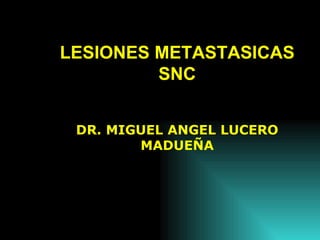 LESIONES METASTASICAS SNC DR. MIGUEL ANGEL LUCERO MADUEÑA 