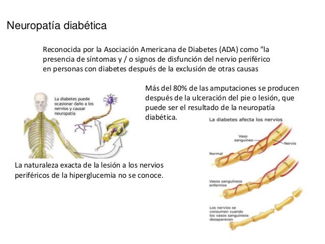 Lesiones micro y macro en diabetes Lesiones micro y macro en diabetes