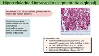 Glom R Chachu Lesiones morfológicas del glomérulo Nefrologia | PPTX