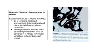 Glom R Chachu Lesiones morfológicas del glomérulo Nefrologia | PPTX