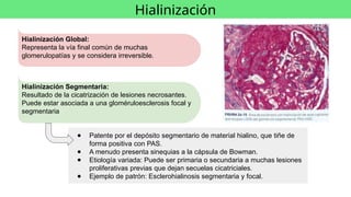 Glom R Chachu Lesiones morfológicas del glomérulo Nefrologia | PPTX