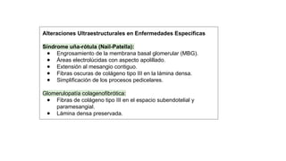 Glom R Chachu Lesiones morfológicas del glomérulo Nefrologia | PPTX