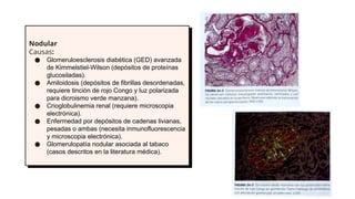 Glom R Chachu Lesiones morfológicas del glomérulo Nefrologia | PPTX