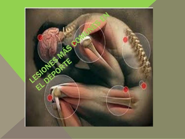 Resultado de imagen para LAS LESIONES EN LOS DEPORTES,