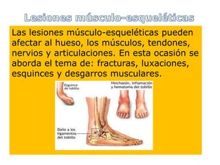 Las lesiones músculo-esqueléticas pueden
afectar al hueso, los músculos, tendones,
nervios y articulaciones. En esta ocasión se
aborda el tema de: fracturas, luxaciones,
esguinces y desgarros musculares.
 