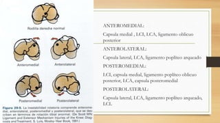 ANTEROMEDIAL:
Capsula medial , LCI, LCA, ligamento oblicuo
posterior
ANTEROLATERAL:
Capsula lateral, LCA, ligamento poplíteo arqueado
POSTEROMEDIAL:
LCI, capsula medial, ligamento poplíteo oblicuo
posterior, LCA, capsula posteromedial
POSTEROLATERAL:
Capsula lateral, LCA, ligamento poplíteo arqueado,
LCL
 