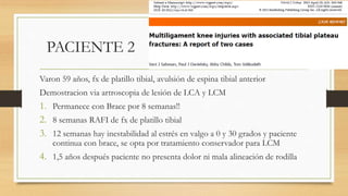 PACIENTE 2
Varon 59 años, fx de platillo tibial, avulsión de espina tibial anterior
Demostracion via artroscopia de lesión de LCA y LCM
1. Permanece con Brace por 8 semanas!!
2. 8 semanas RAFI de fx de platillo tibial
3. 12 semanas hay inestabilidad al estrés en valgo a 0 y 30 grados y paciente
continua con brace, se opta por tratamiento conservador para LCM
4. 1,5 años después paciente no presenta dolor ni mala alineación de rodilla
 