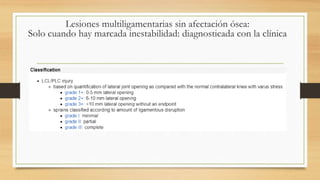 Lesiones multiligamentarias sin afectación ósea:
Solo cuando hay marcada inestabilidad: diagnosticada con la clínica
 