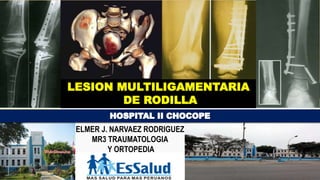 LESION MULTILIGAMENTARIA
DE RODILLA
ELMER J. NARVAEZ RODRIGUEZ
MR3 TRAUMATOLOGIA
Y ORTOPEDIA
 