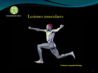Lesiones musculares Profesor Leopoldo Rosales Universidad de Colima 